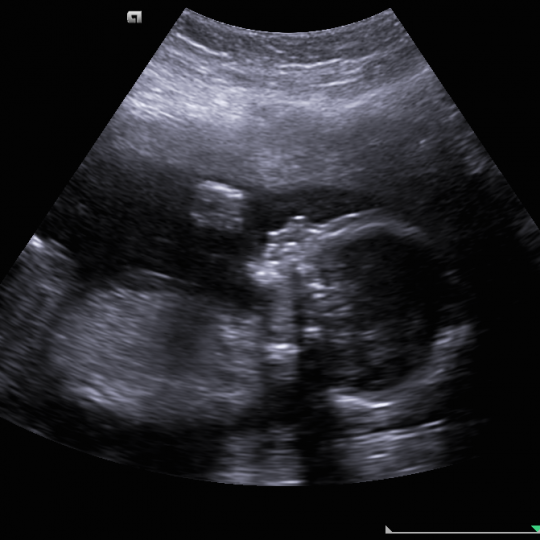 http://www.drkanupriya.com/wp-content/uploads/2015/12/Anomaly-pregnancy-scan-540x540.png