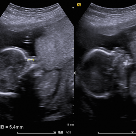 http://www.drkanupriya.com/wp-content/uploads/2015/12/Pregnancy-Anomaly-Scan-2-540x540.png